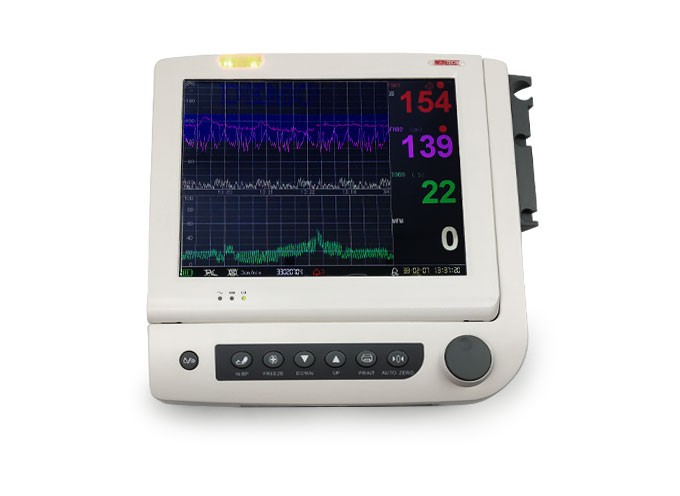 12英寸大屏幕带打印机胎儿监护仪图2
